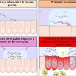 Etapas en la infección por Helicobacter pylori