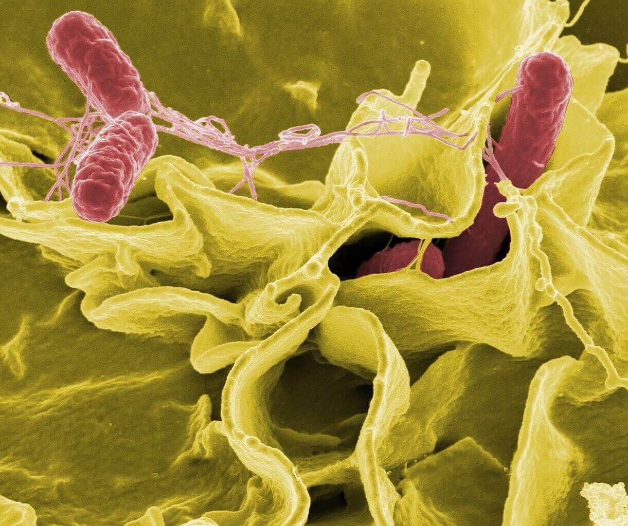La presencia de salmonella en intestinos puede generar la salmonelosis