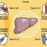 Vias transmision www.gastroenterologos.net images hepatitis