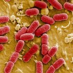 Presencia de E. coli en intestinos