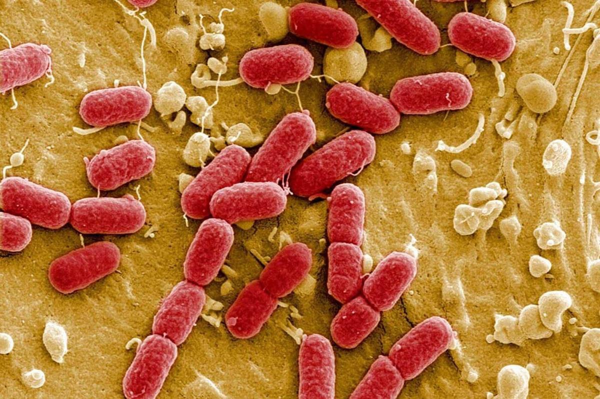 Infección por E. coli: molesta y frecuente