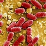 Presencia de E. coli en intestinos-644×362