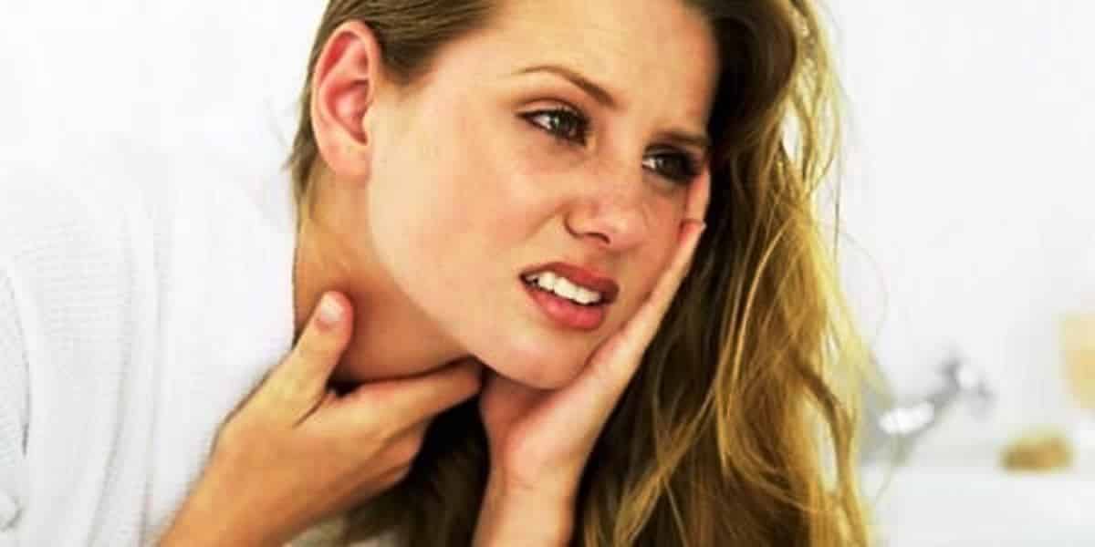 El dolor de garganta aparece frecuentemente entre las manifestaciones de mononucleosis anginas con pus