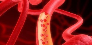 anemia y alimentacion