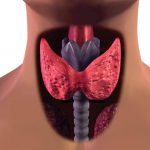 El hipotiroidismo es consecuencia de un funcionamiento insuficiente la glándula tiroidea