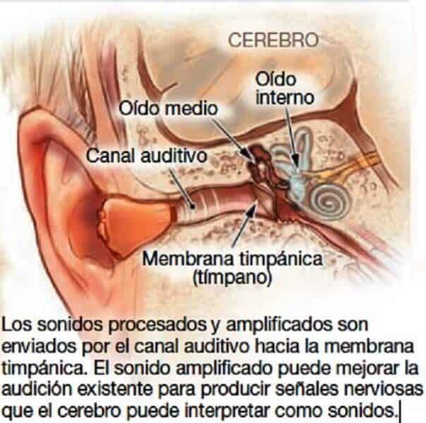 Trastornos de la audición: sordera