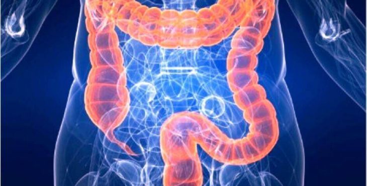 El colon irritable o síndrome del intestino irritable (SII) es un problema gastrointestinal que se acompaña de dolor abdominal y cambios en el ritmo intestinal
