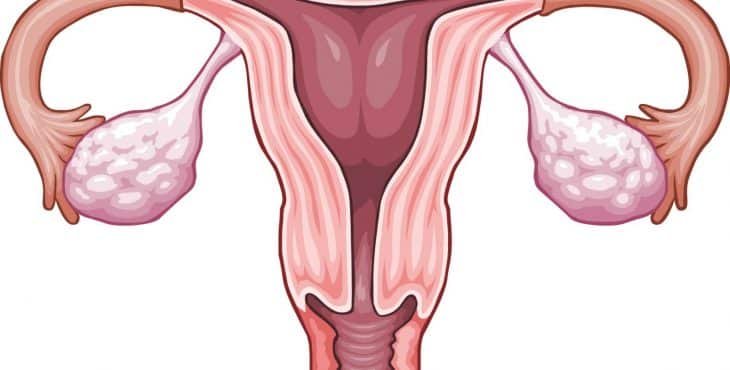 Sintomas cancer de utero
