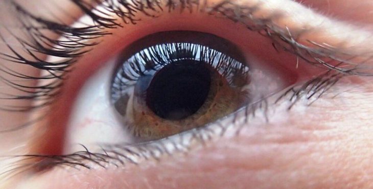 Las cataratas bloquean la luz, dificultando ver con nitidez y con claridad por un enturbiamiento progresivo del lente del ojo (cristalino).
