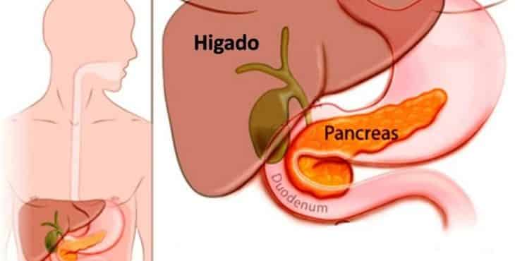 El páncreas se encuentra localizado en la parte superior trasera del abdomen, jugando un importante papel en la digestión, de ahí que su inflamación, conocida como pancreatitis, puede afectar su normal funcionamiento