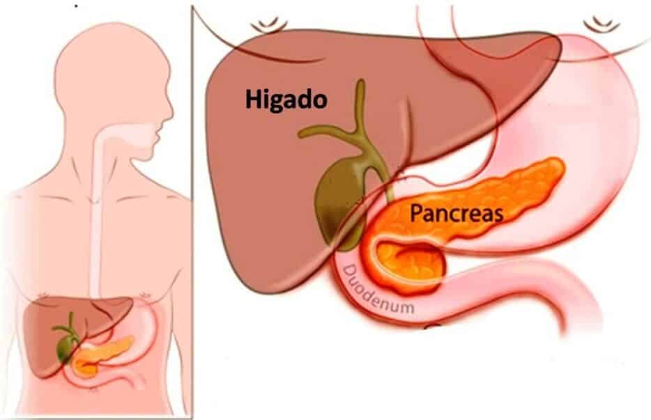 ¿Que es la Pancreatitis? tipos, causas y tratamientos