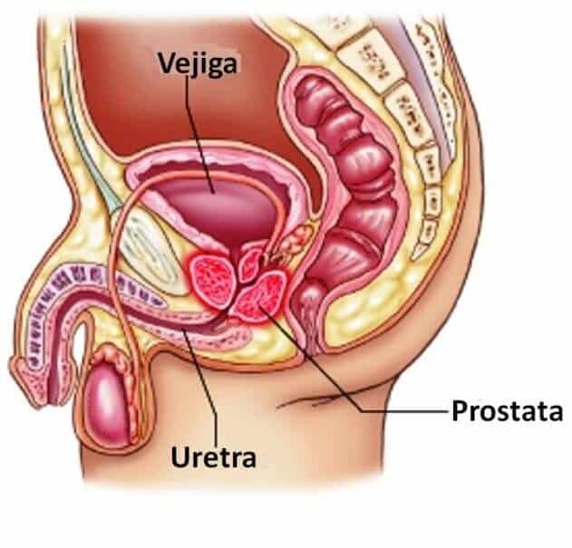 La prostatitis es la inflamación de la próstata, glándula en forma de nuez localizada por debajo de la vejiga y delante del recto y que rodea la uretra