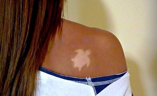 Los tatuajes de sol son la consecuencia del impacto de las radiaciones solares que provocan quemaduras sobre la piel dejando la huella de la imagen deseada