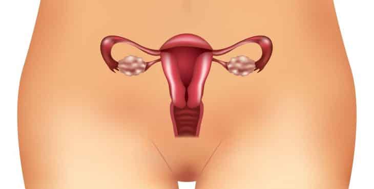 sindrome de ovario poliquistico detectar la ovulación
