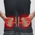 El dolor de riñones puede ser confundido con dolores de costado o de espalda
