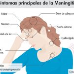 Meningitis 3