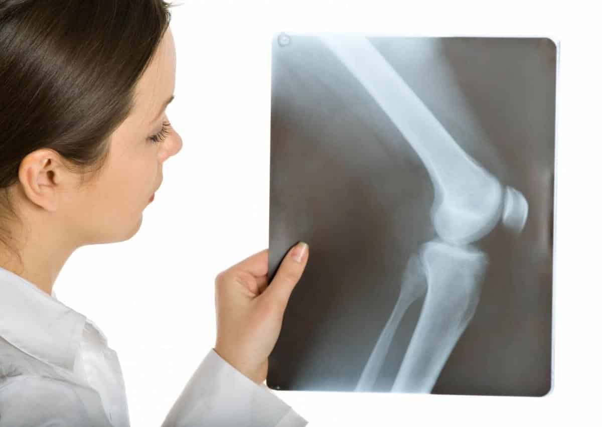 ¿Cómo andan mis huesos? Hablemos de osteoporosis…