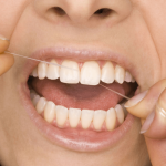 2-Una correcta higiene bucal evita el sangrado