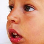 Caracteristicas del niño respirador bucal