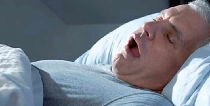 La apnea obstructiva del sueño se caracteriza por interrumpir la respiración por más de 10 segundos