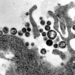 Virus de la fiebre de Lassa (2)
