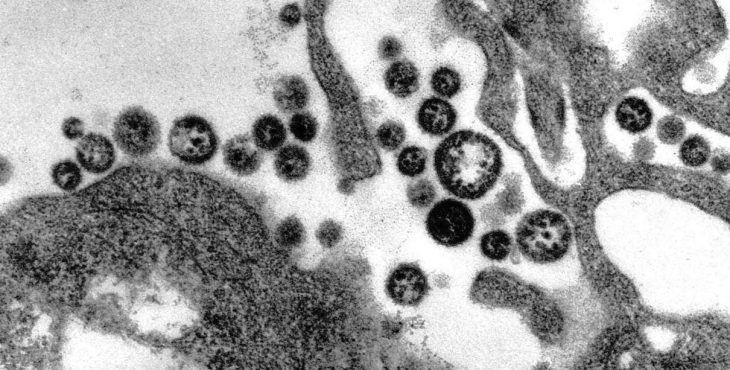El virus de la fiebre de Lassa también se transmite por aerosoles de saliva