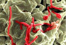 Cómo se transmite el ébola La fiebre de Lassa está causada por un tipo de virus de la familia arenavirus, del mismo tipo del que causa el Ebola