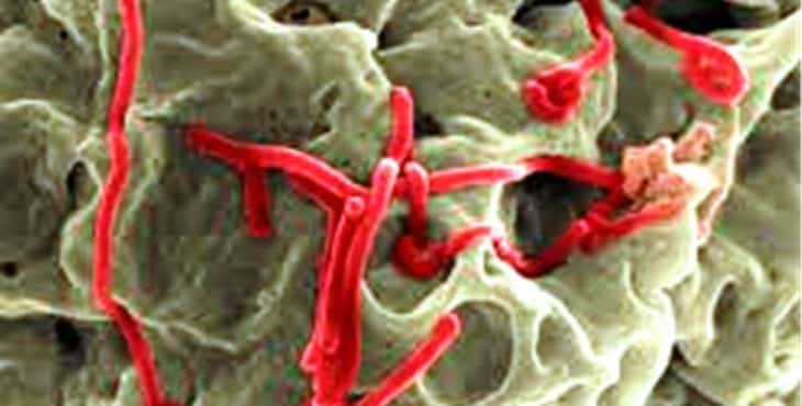 La fiebre de Lassa está causada por un tipo de virus de la familia arenavirus, del mismo tipo del que causa el Ebola