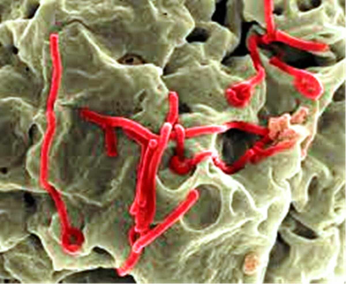 Cómo se transmite el ébola La fiebre de Lassa está causada por un tipo de virus de la familia arenavirus, del mismo tipo del que causa el Ebola