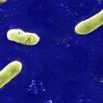 Bacteria causante de la tos ferina