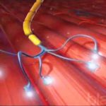 Interconexiones nerviosas en la esclerosis lateral amiotrófica