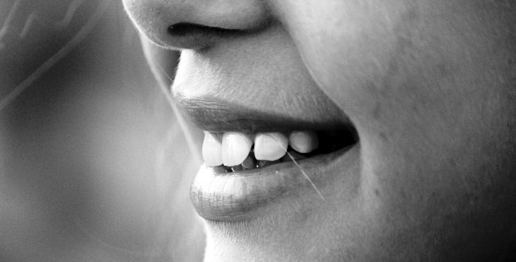 Características de los dientes predispone al traumatismo