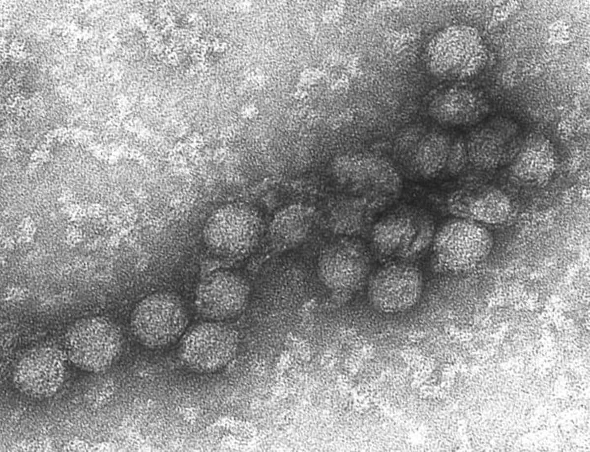 El virus que ocasiona la enfermedad del Nilo Occidental