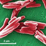 Bacteria Mycobacterium tuberculosis causante de la tuberculosis