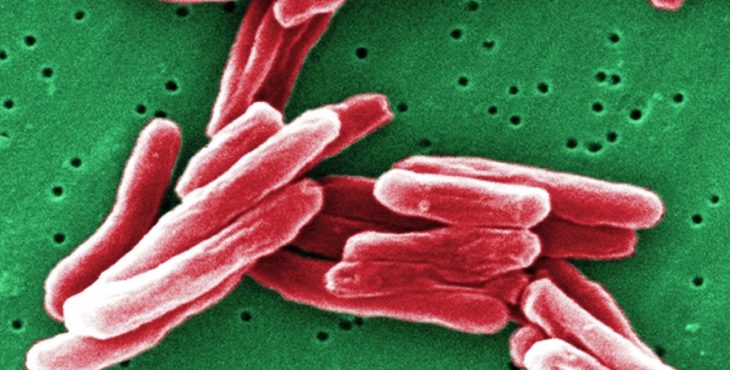 Imagen de la bacteria Mycobacterium tuberculosis que ocasiona la tuberculosis