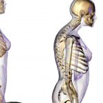 La sarcopenia modifica las estructuras anatómicas de los seres humanos