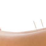acupuntura-madrid-4