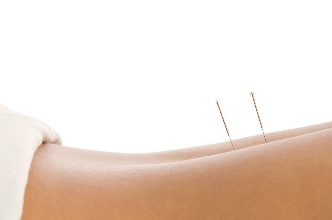 La acupuntura sirve para tratar síntomas y dolencias de todo tipo