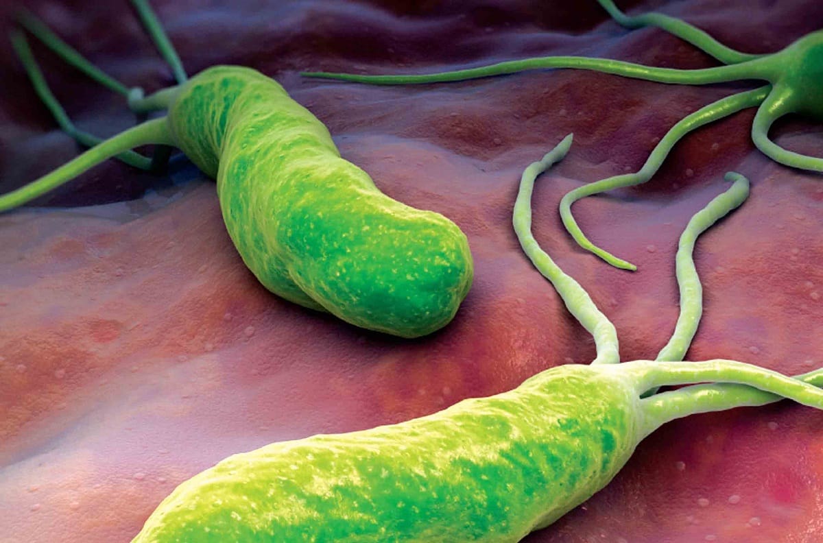 Dieta helicobacter pylori, palia sus efectos con la alimentación