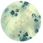 Bacteria Streptococcus pyogenes causante de la escarlatina