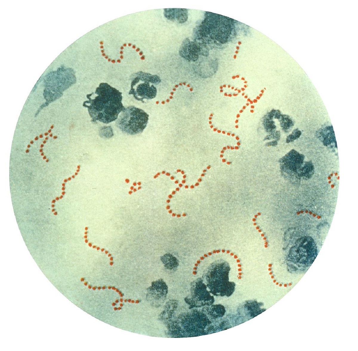 Bacteria causante de la fiebre escarlatina