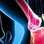 Erosiones articulares en la artritis reumatoide