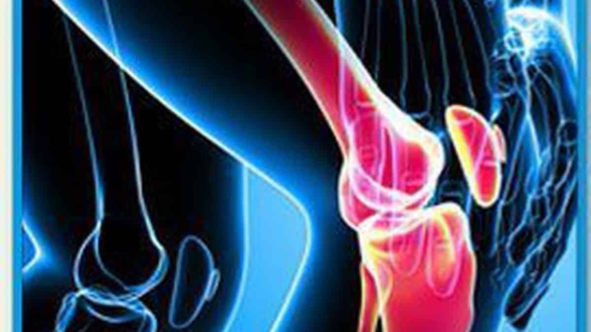 La artritis reumatoide destruye las articulaciones 