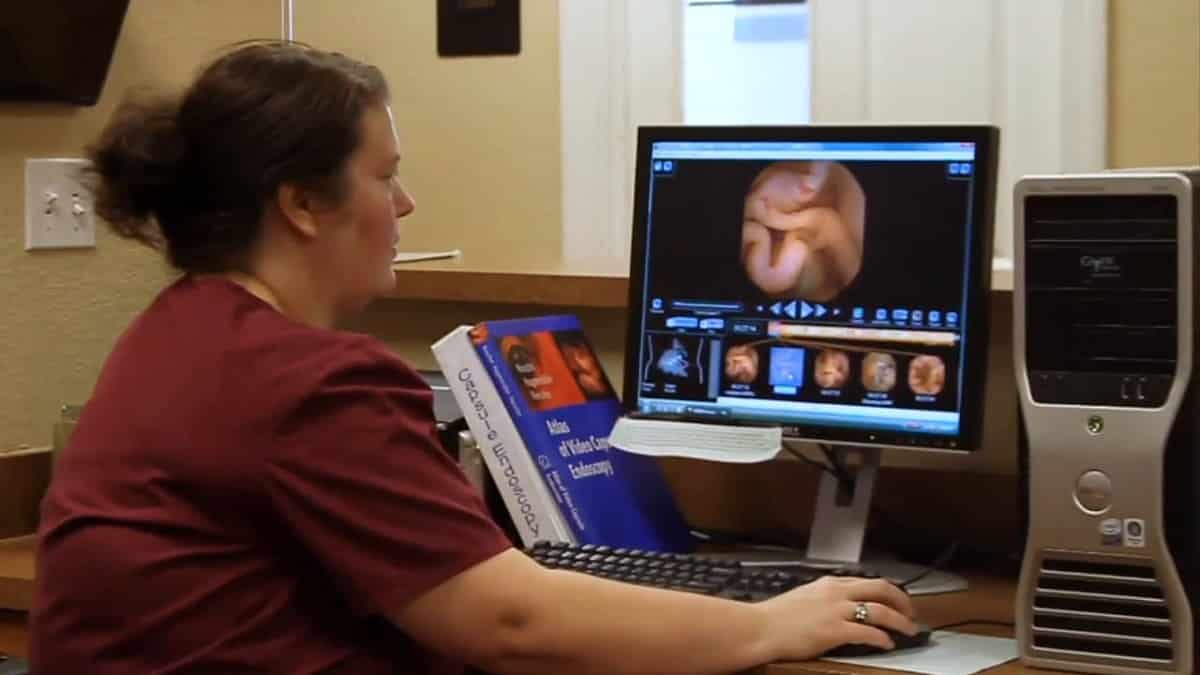 Los exámenes de imágenes son imprescindibles para la detección de pólipos en el colon