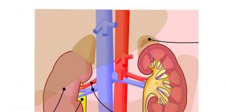Conservación del organo para trasplante de riñón