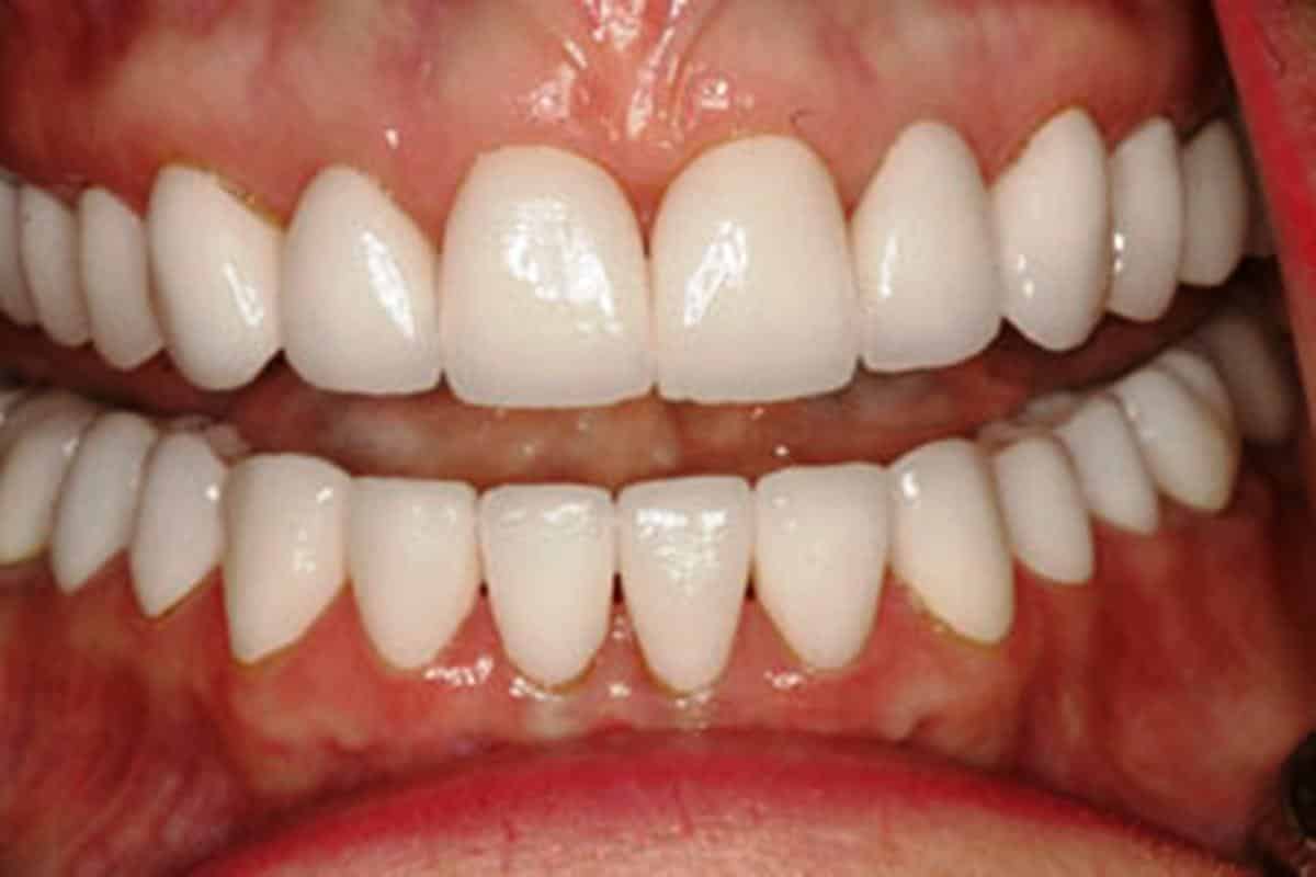 Arcadas dentarias