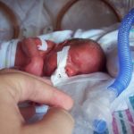 2-Los partos prematuros requieren cuidados especiales