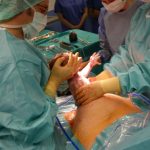 2-En muchas ocasiones los bebes grandes requieren nacer por cesarea