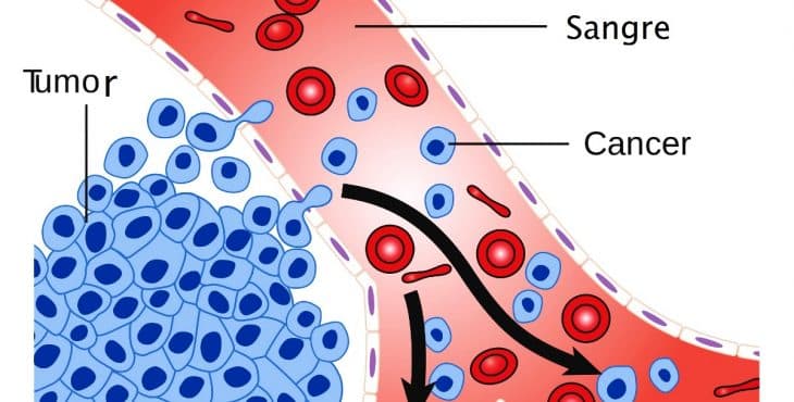 Diseminación a través de la sangre de células cancerosas