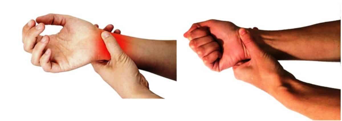 Lesiones de las manos antebrazo por esfuerzo repetitivo